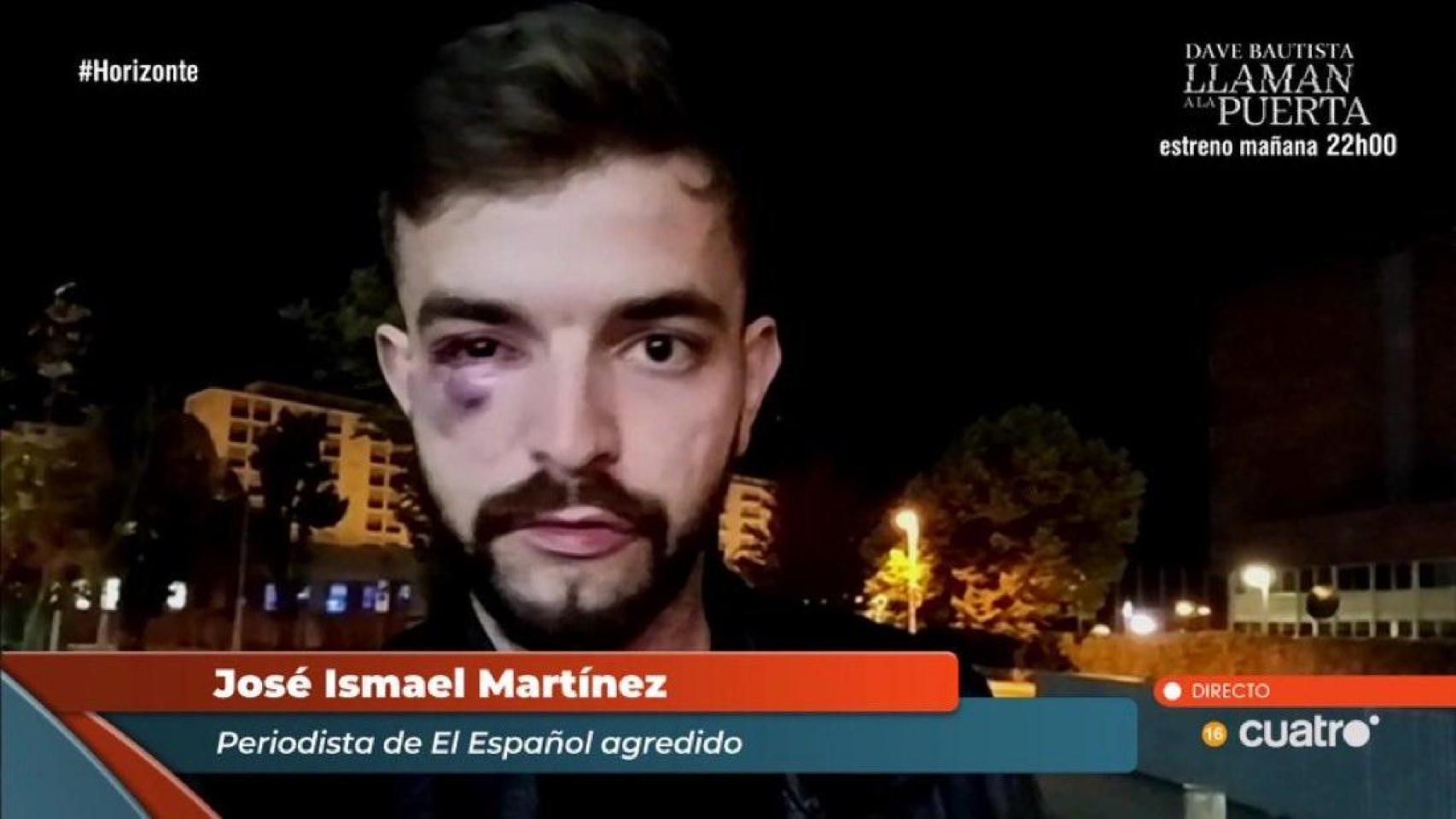 Los medios condenan la agresión al periodista de El Español José Ismael Martínez en la Universidad de Navarra