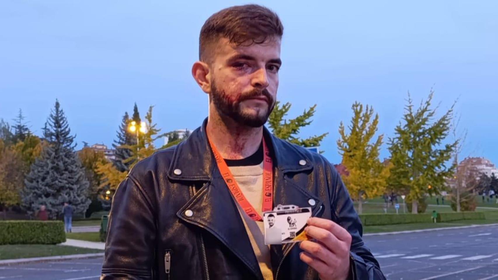  Recibí pedradas, patadas... No sé cuántos golpes me dieron: el infierno que viví informando de la  kale borroka  en Pamplona 