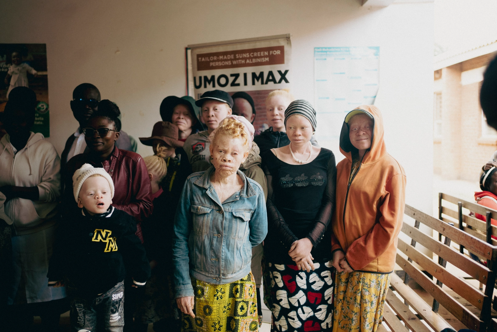 Foto diecisiete sobre el Albinismo en Malawi