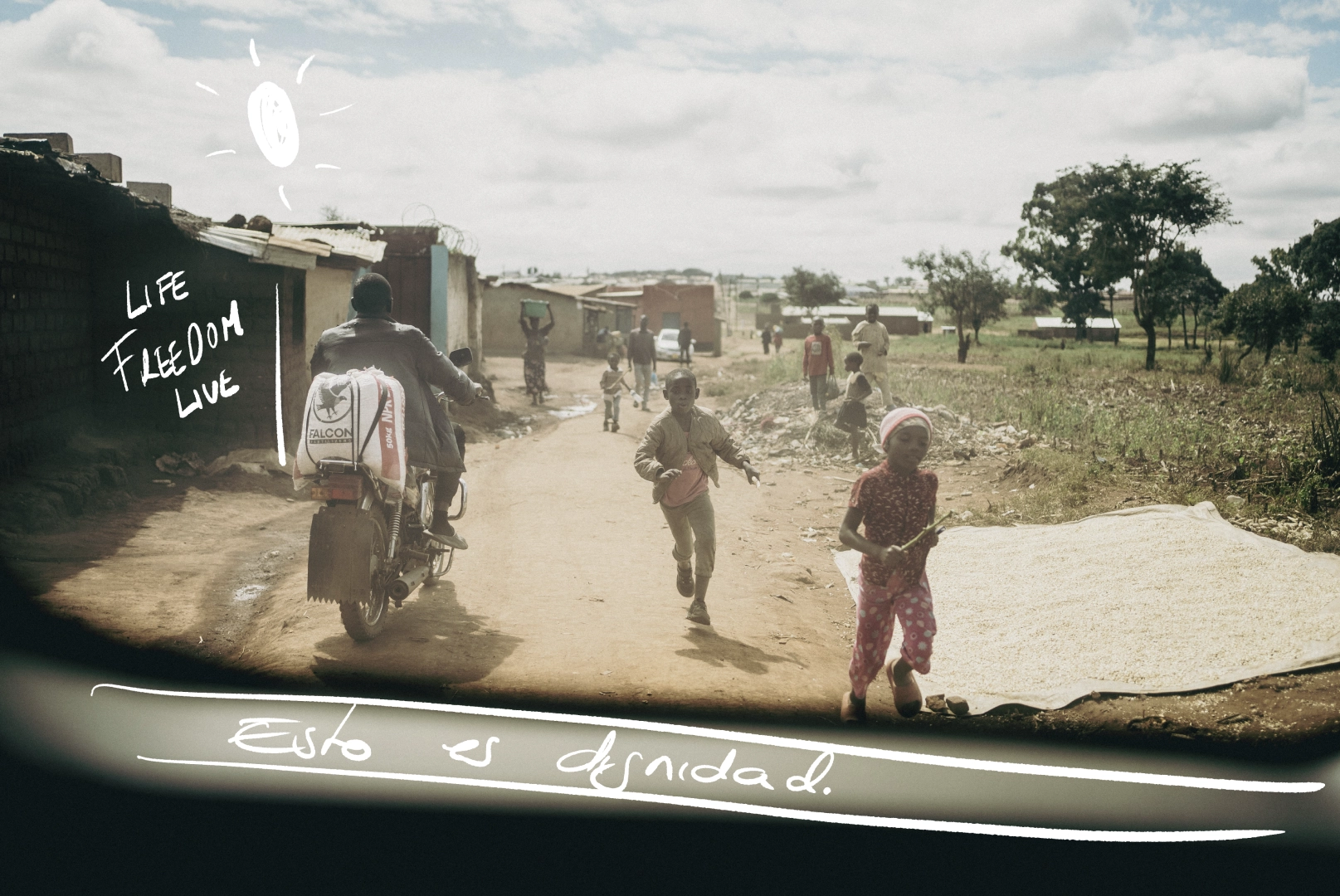 Foto veinte sobre el Albinismo en Malawi